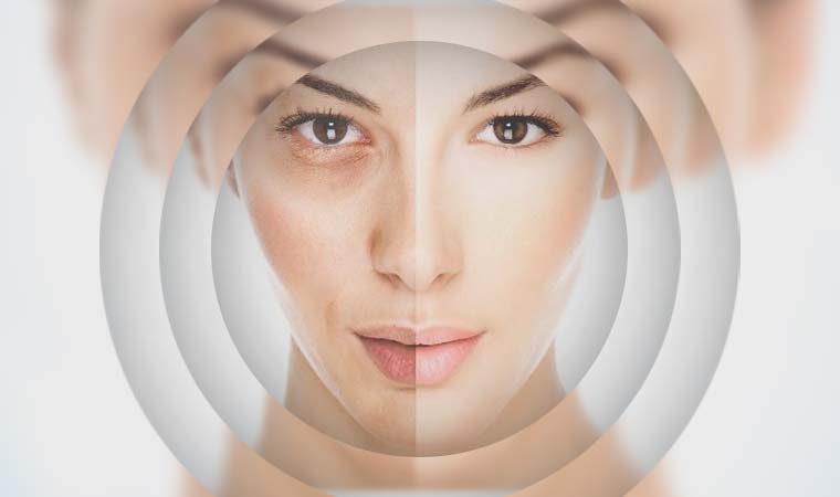 Su İçmenin Cilde Faydaları